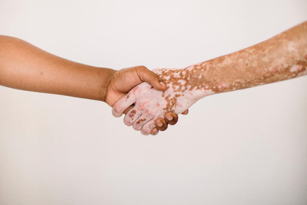 solidarity